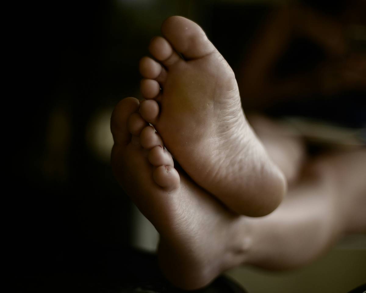 Diagram showing foot skin layers with low sebum glands and thick stratum corneum compared to facial skin