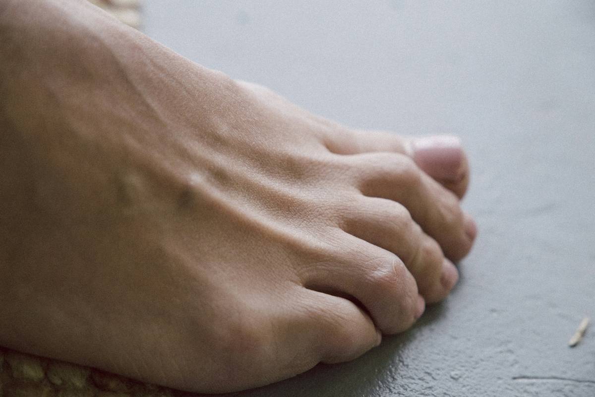 comparison of dry vs hydrated feet after using most hydrating foot cream regimen