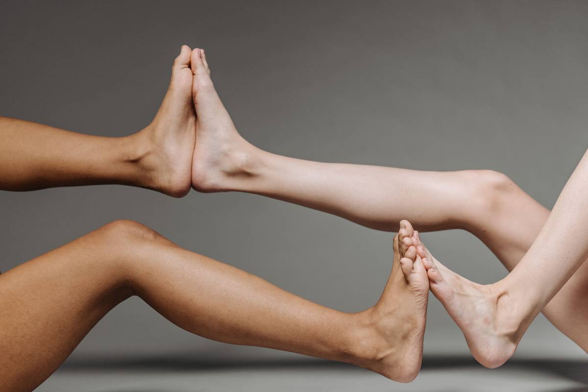 Close-up of cracked heels being treated with cream for extremely dry feet